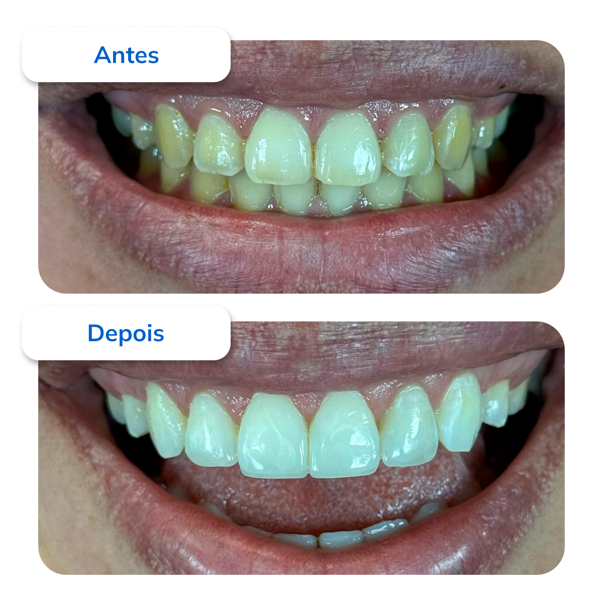 Periodontia